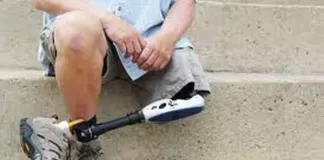 પ્રોસ્થેટિક્સ, ઓર્થોટિક્સ અને એક્સોસ્કેલેટન્સ: માનવીની ગતિશીલતામાં નવી ક્રાંતિ સર્જે છે! Prosthetics-orthotics-and-exoskeletons